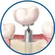 Patient Material - Restorative Dentistry - Image5