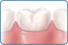 Patient Material - Why a Regular Dental Check Up is Important - Image 1