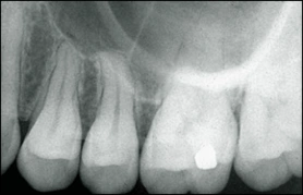 radiograph of foreshortened image