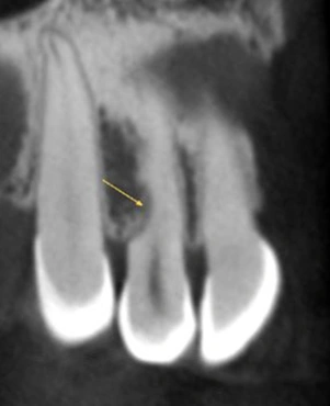 Endodontics - Figure 1