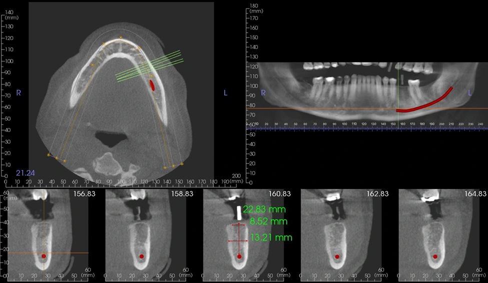 Implant Dentistry - Figure 1