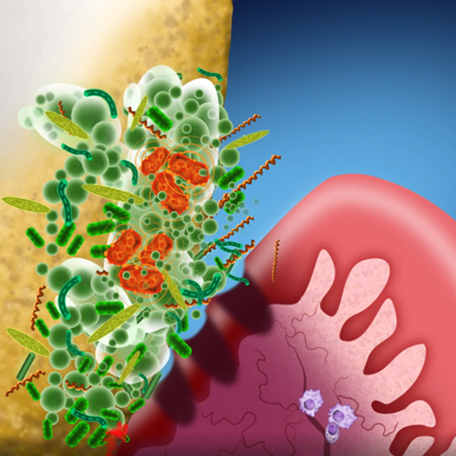 The Oral Microbiome: A New View of Plaque Biofilm