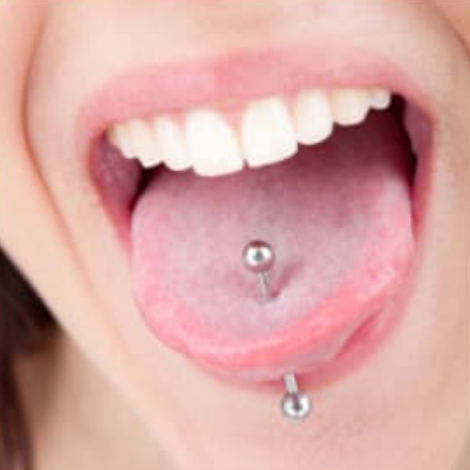 Oral Piercings: Implications for Dental Professionals