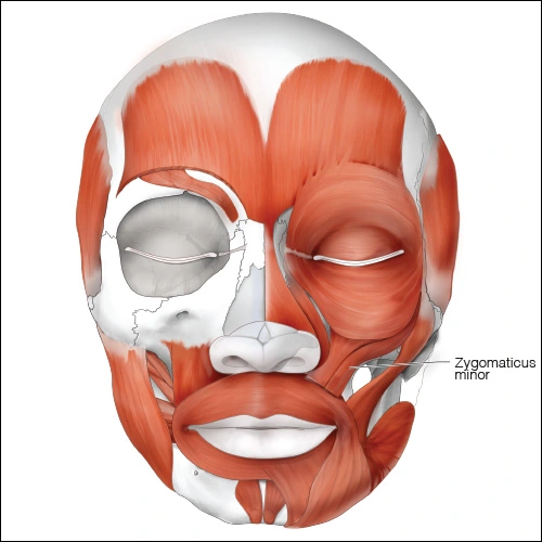 Illustration showing the zygomaticus minor muscle