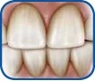 Patient Material - Teeth Whitening – Dental Care - Image 1