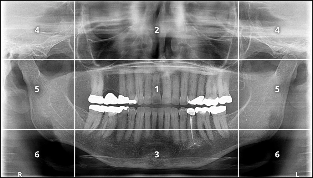 Image of zones of interpretation.