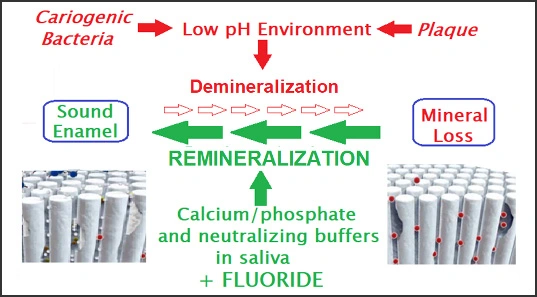 Diagram showing remineralization process with the addition of Fluoride