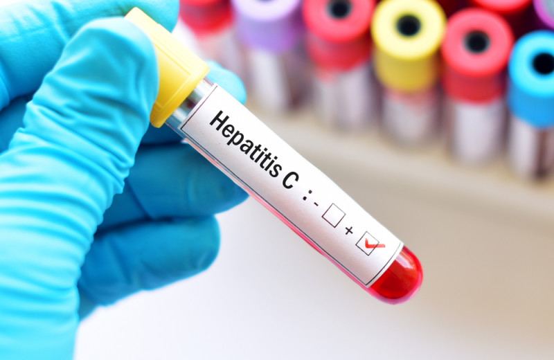 The Signs Older Americans Need To Know About Hepatitis C