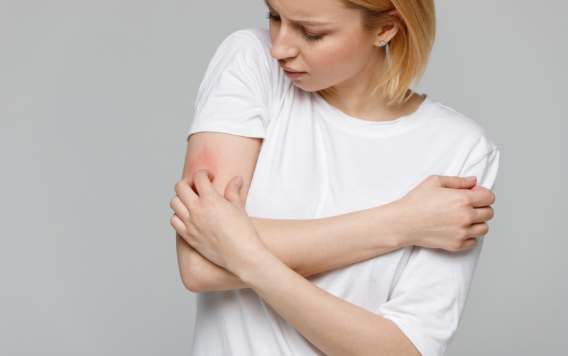 Dry Skin or Winter Rash? How to Differentiate and Treat
