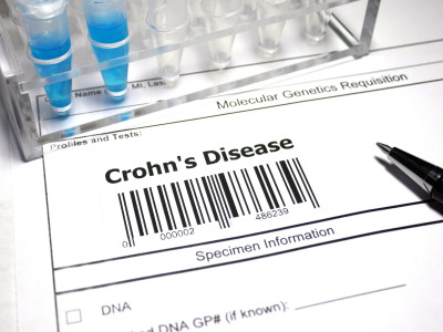 Everything You Need to Know About Crohn's Disease