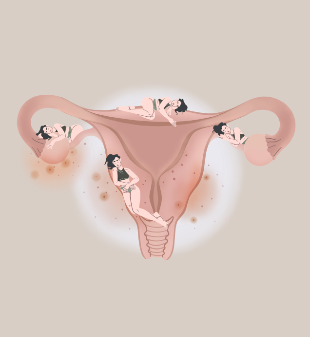 The Zoom In: Prostaglandins and your Cycle