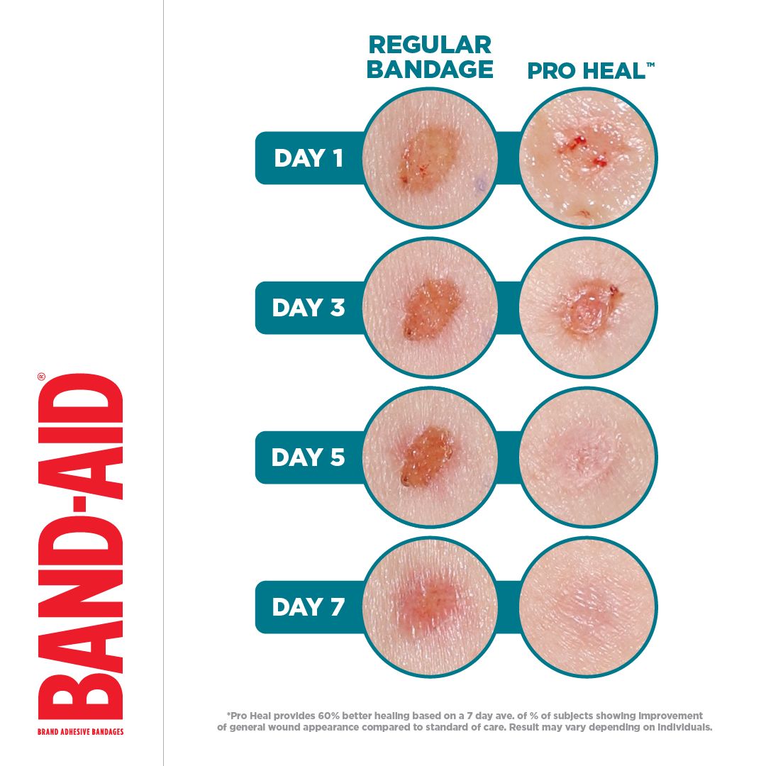 Pansements réguliers par rapport aux pansements PRO HEAL™ de la marque BAND-AID® au jour 1, 3, 5 et 7