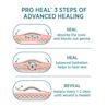 Band-Aid Pro Heal Adhesive Bandages offer 3 steps of advanced healing: seal, heal and reveal