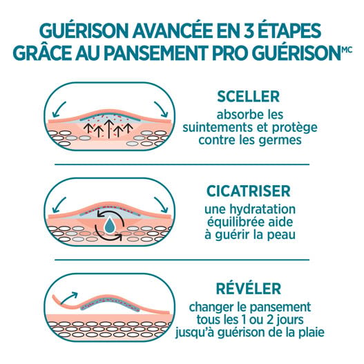Les pansements adhésifs Band-Aid Pro Guérison offrent une guérison avancée en 3 étapes : sceller, cicatriser et révéler