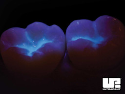 5 UltraSeal-XT-hydro-Step-by-Step Fluorescence