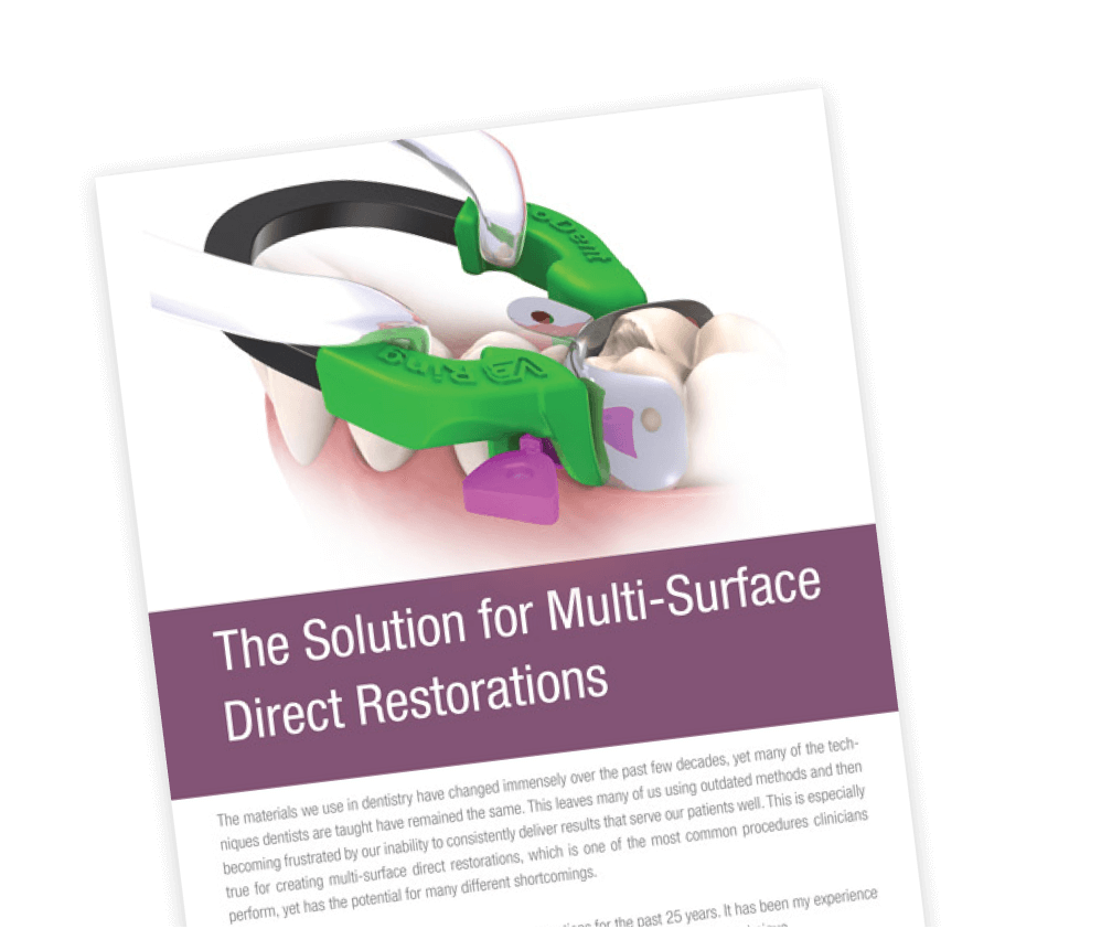 The Solution for Multi-Surface-Direct Restorations - Download