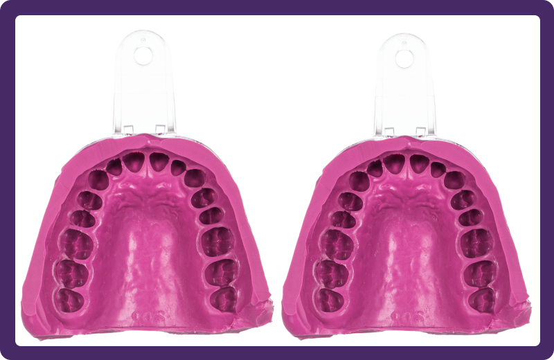 Thermo Clone Alginate Alternative Impression After 24 Hours