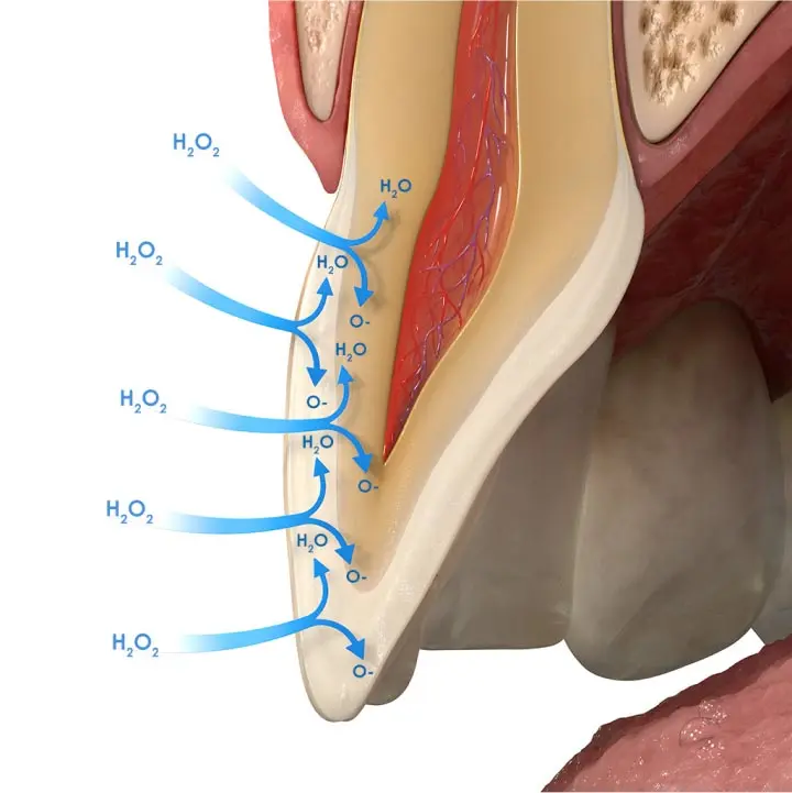 Opalescence whitening obsorbing into tooth