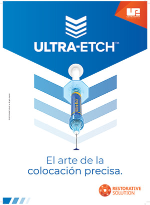 Ultra-Etch-Brochure-Thumb-ES-2026
