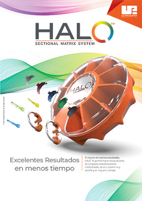 Halo-Sales-Sheet-Thumbnail-ES