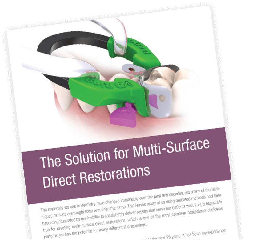 The Solution for Multi-Surface Direct Restoration by Dr Michael Miyasaki