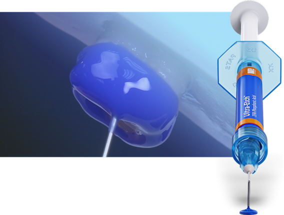 Closeup of Ultra-Etch syringe in use