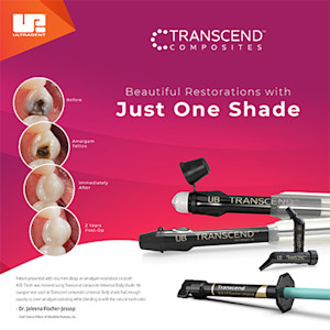 Transcend-Composites-Brochure-Thumbnail-1012509AR04