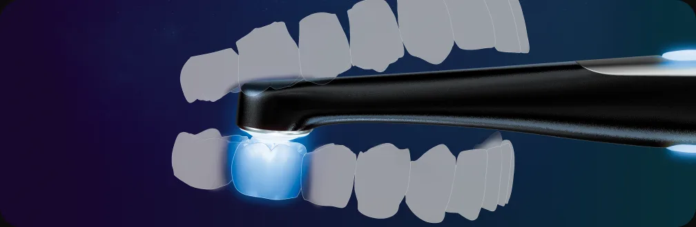 VALO X curing light low-profile access
