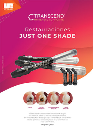 Transcend-Sales-Sheet-Thumbnail-ES