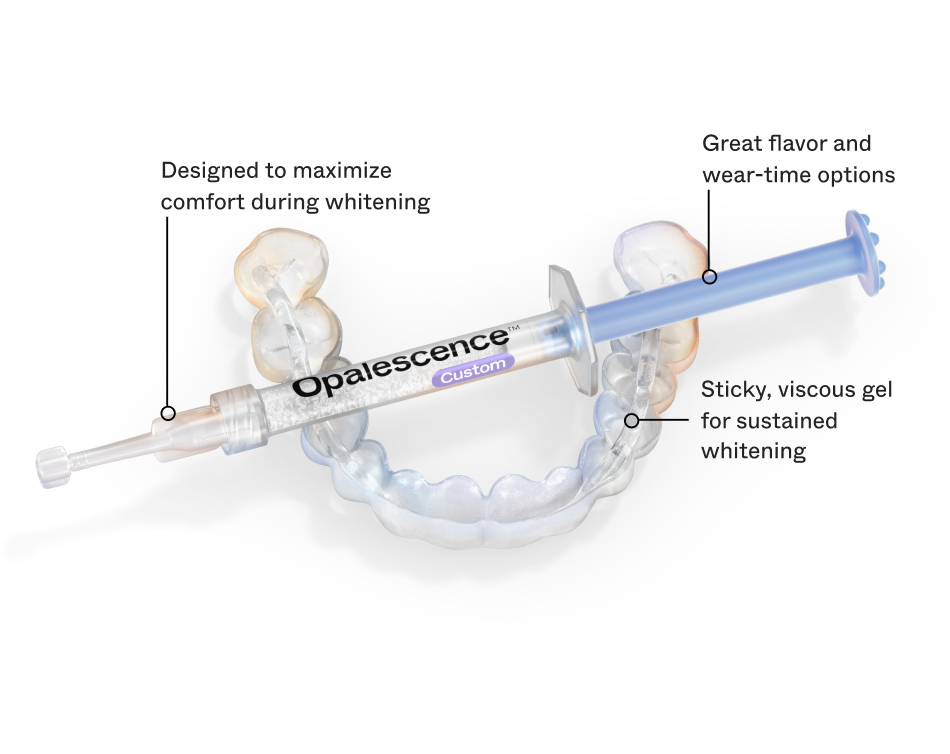 Opalescence Custom Tray