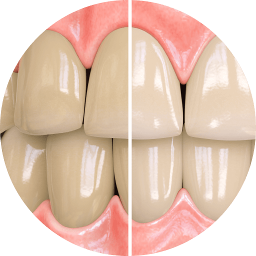 Паста за зъби Opalescence