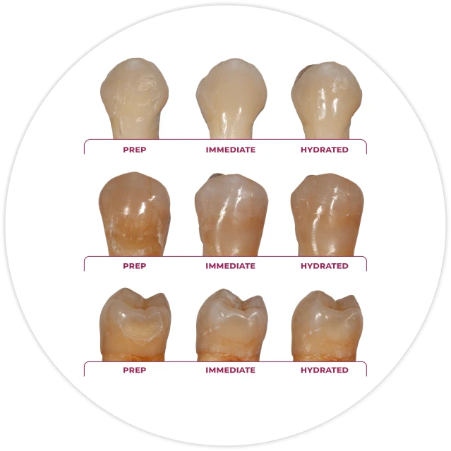 Shade adaptability before placement, immediately after, and after hydration