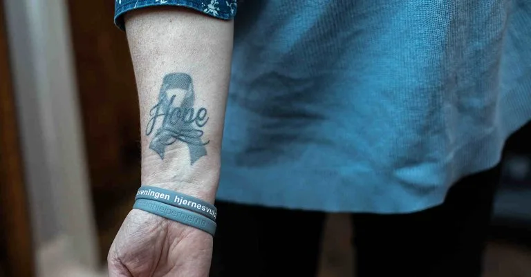 Tatovering av hjernesvulstsløyfe Forarm med tatovering av hjernesvulstsløyfe