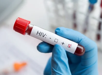 Decorative image relating to Global HIV/AIDS response