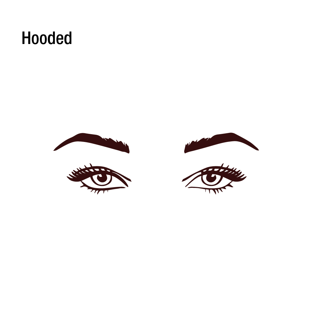 Graphic showing hooded eyes which have partially hidden lid space