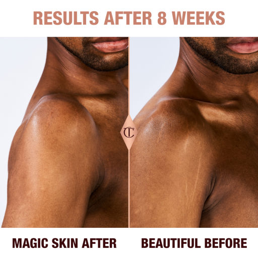 Results of Magic Body Cream after 8 weeks on a deep skin male model