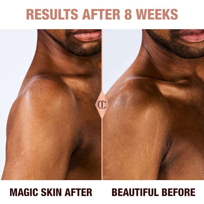 Results of Magic Body Cream after 8 weeks on a deep skin male model Results of Magic Body Cream after 8 weeks on a deep skin male model