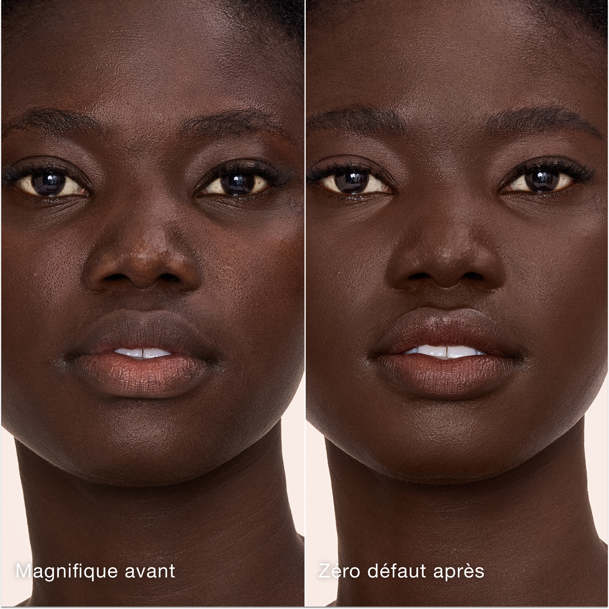 Comparaison côte à côte montrant la peau avant et après l'application de l'Airbrush Flawless Concealer de Charlotte Tilbury, avec les étiquettes de texte « Magnifique avant » et « Zéro défaut après ».