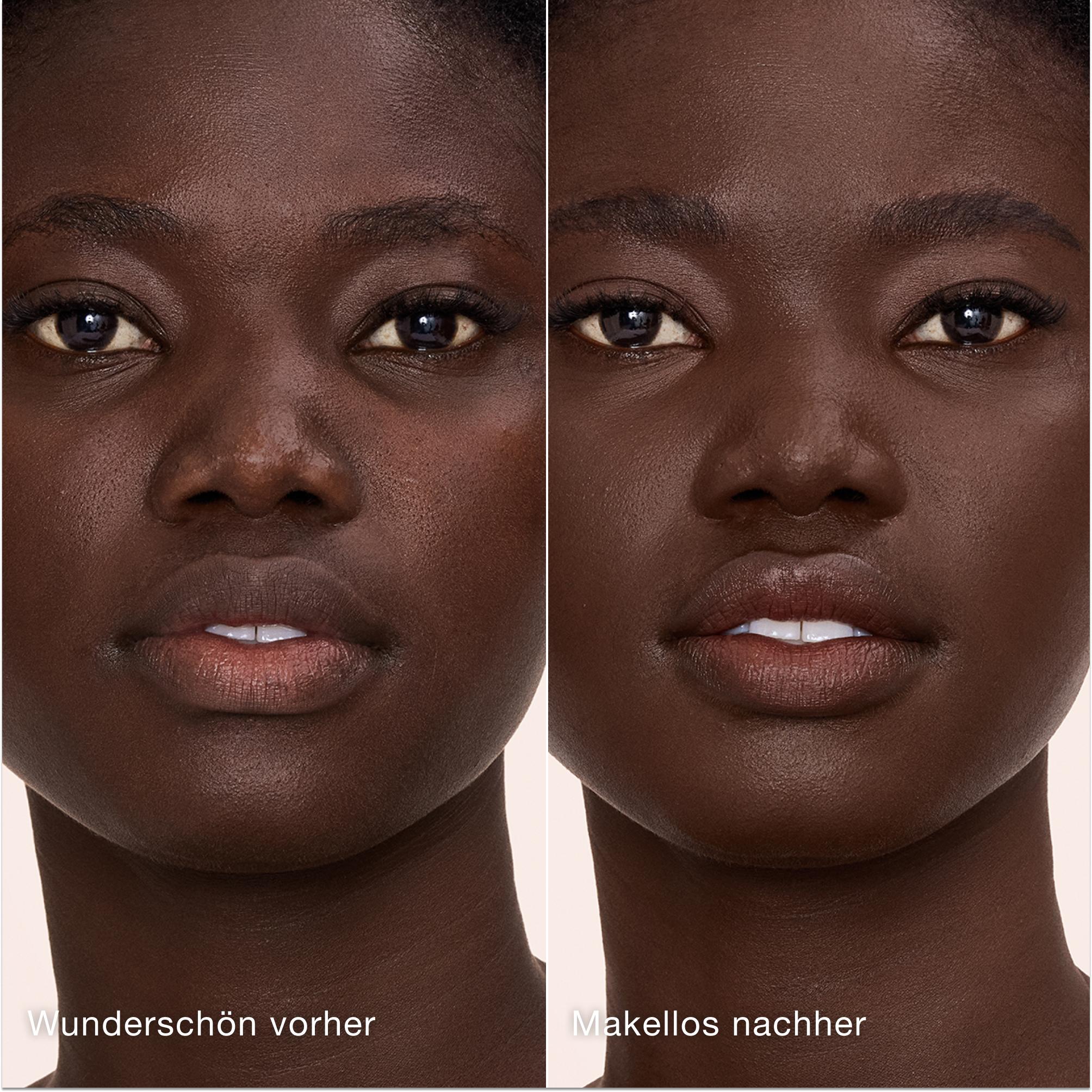 Ein direkter Vergleich zeigt die Haut vor und nach dem Auftragen des Charlotte Tilbury Airbrush Flawless Concealers mit den Beschriftungen „Wunderschön vorher“ und „Makellos nachher“.