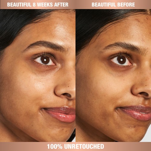 Close-up before and after of a medium-tone model with dark undereye area in a the before shot and bright undereye area after using an eye cream in the after shot. 