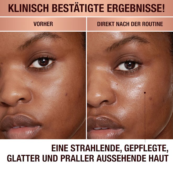 Magic Cream – Vorher und nachher Magic Cream – Vorher und nachher