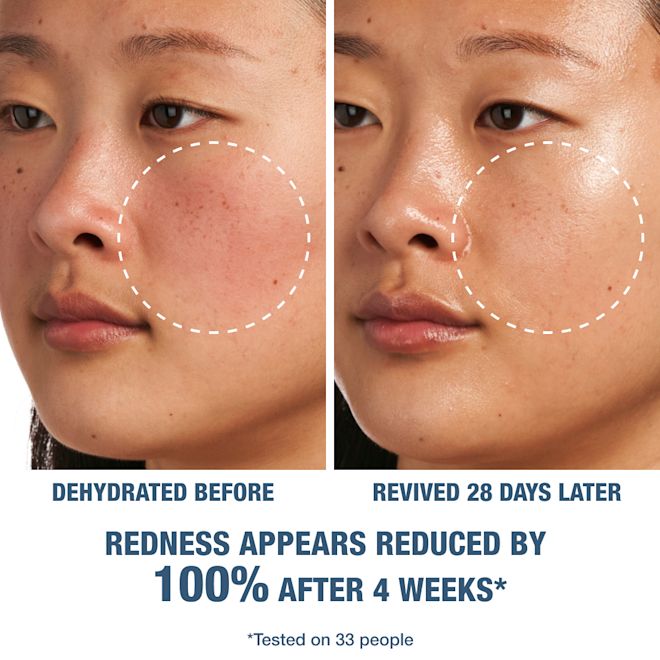Dehydrated before applying magic water cream, and revived 28 days later after applying magic water cream An Asian model with signs of dry and unclear skin on the left, and the same model 28 days later with glowing and clearer skin