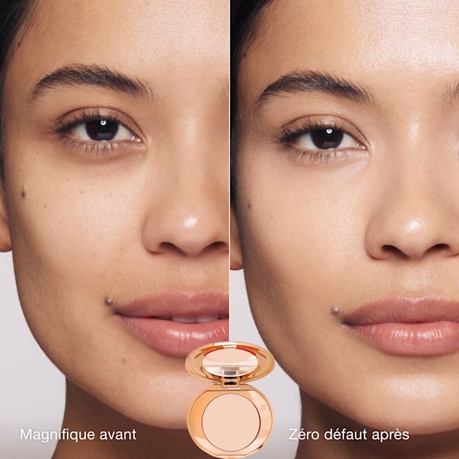 FRCA-MagicVanish Juliana BeforeAfter 1000x1000 FRCA-MagicVanish Juliana BeforeAfter 1000x1000