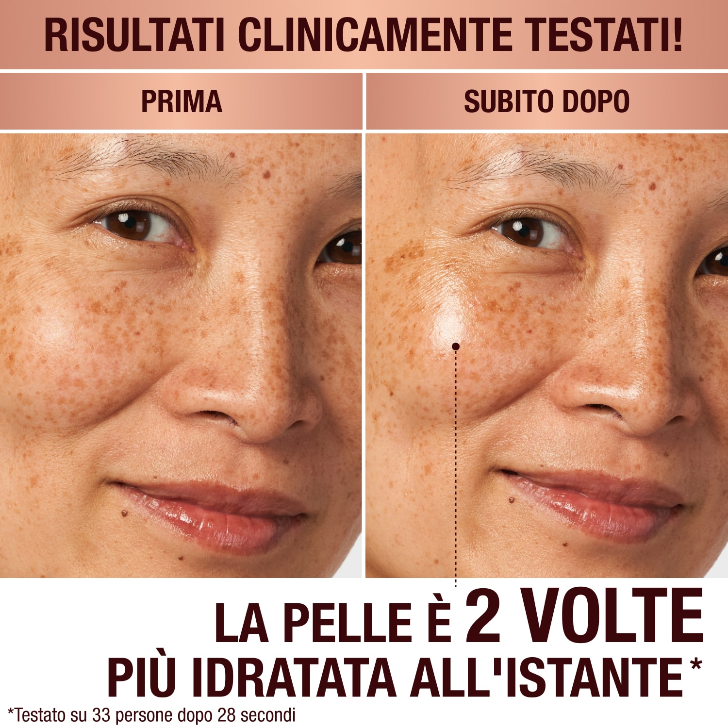 Prima e dopo di una modella dalla pelle chiara: da un lato è senza prodotti per la cura della pelle, dall'altro ha la pelle soda, luminosa e idratata grazie alla crema viso.