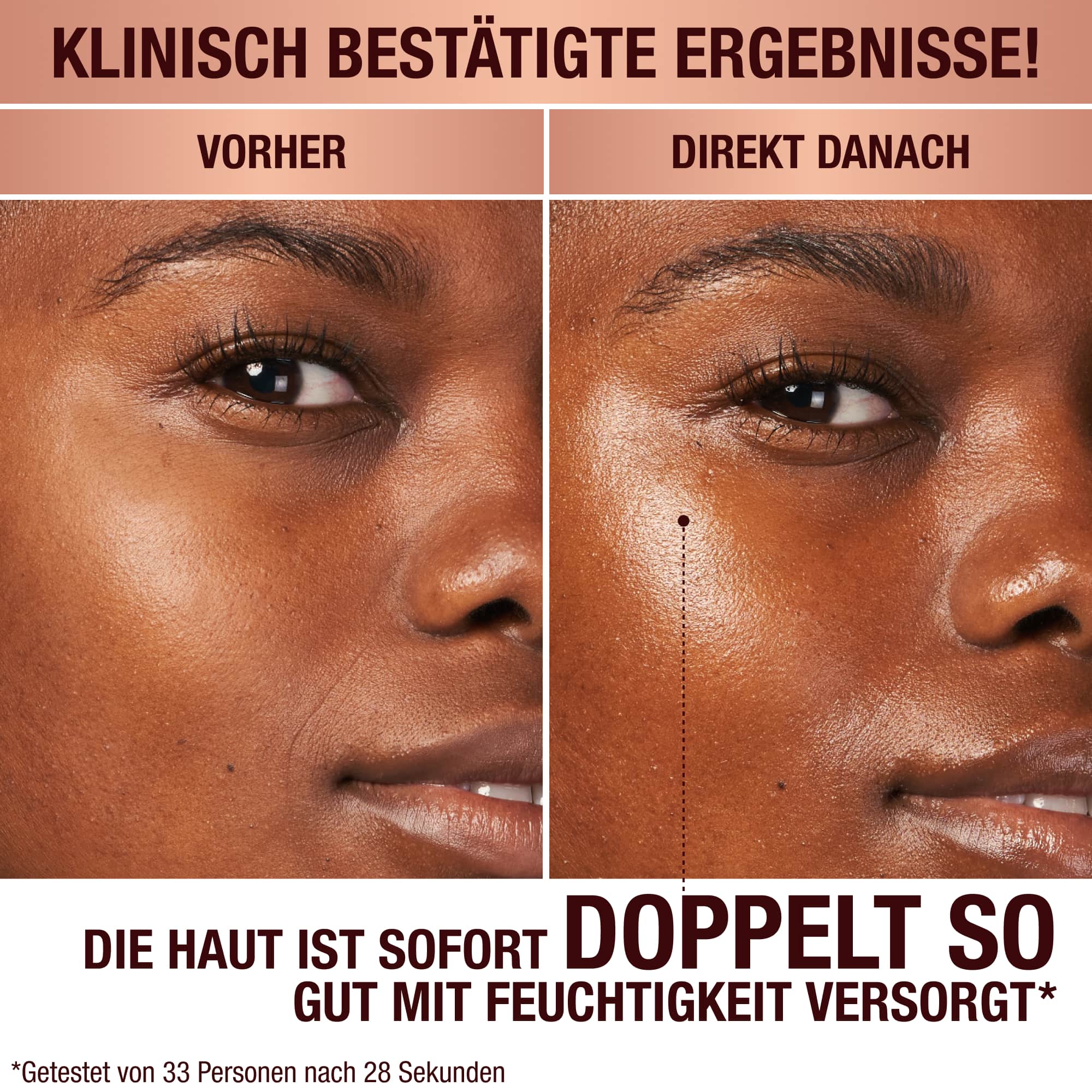 Vorher-Nachher-Bilder eines Models mit dunklem Teint. Ohne jegliche Hautpflege auf der einen Seite und auf der anderen Seite ein Bild, auf dem man das Ergebnis der strahlenden Gesichtscreme sieht, die ihre Haut prall und hydratisiert aussehen lässt.