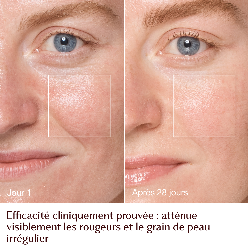 Magic Cream - infographie rougeurs + grain de peau avant/après - mannequin Emily 