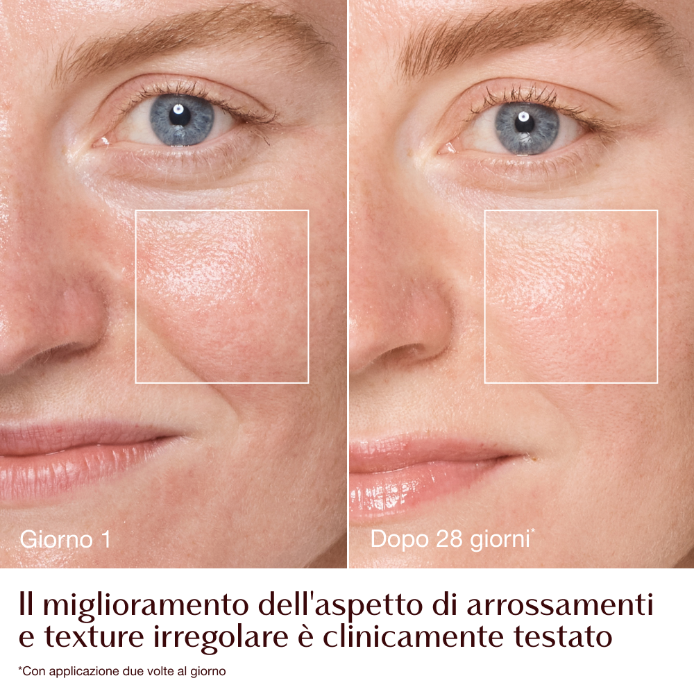 Magic Cream - infografica prima e dopo arrossamenti e grana - modella Emily 