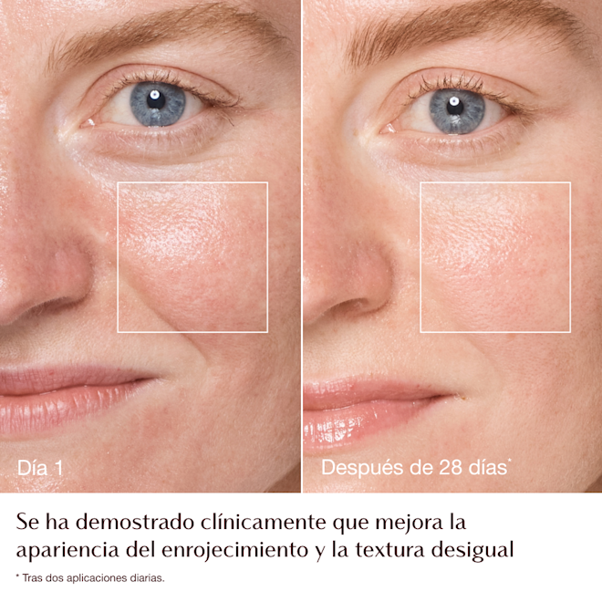 Infografía del antes y el después de la Magic Cream: enrojecimiento y textura: modelo Emily Infografía del antes y el después de la Magic Cream: enrojecimiento y textura: modelo Emily