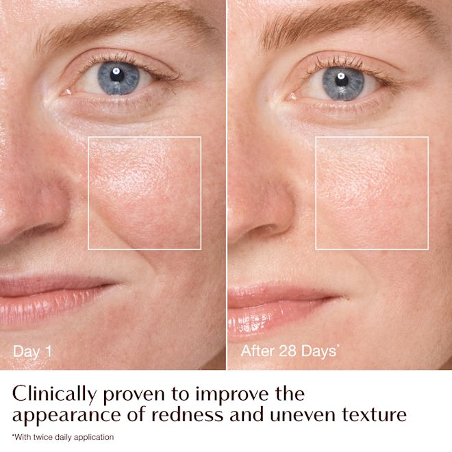Magic Cream - before and after redness + texture infographic - model Emily Magic Cream - before and after redness + texture infographic - model Emily