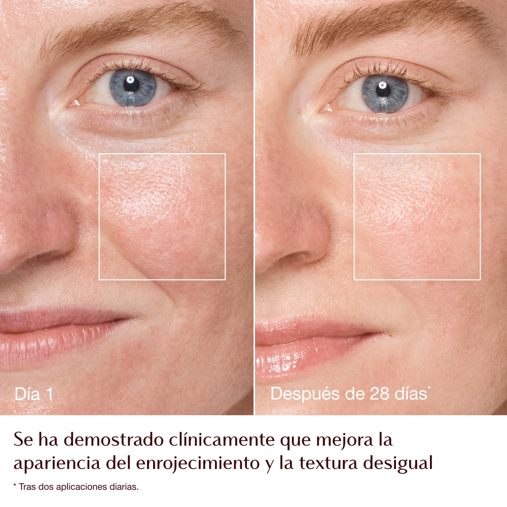 Infografía del antes y el después de la Magic Cream: enrojecimiento y textura: modelo Emily 